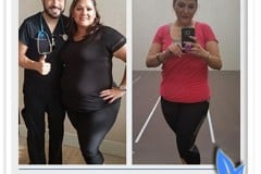 BefAft-Diana-Ramos-5-months-70-lbs