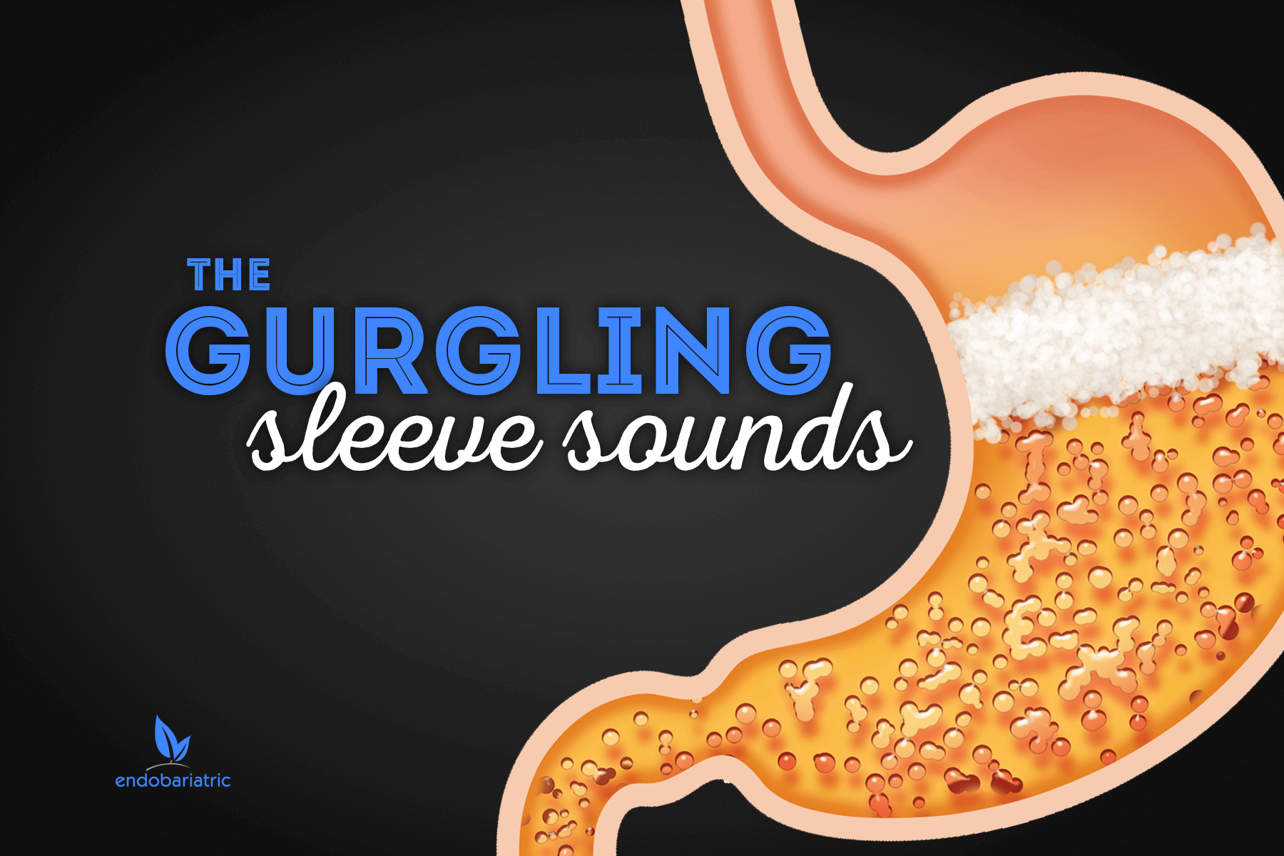 The Gurgling Sleeve Sounds Gastric Sleeve Mexico 