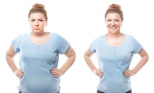 Gastric Sleeve better than Gastric Balloon Mexico
