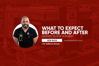 What to Expect Before and After Gastric Sleeve Surgery