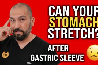 Can Your Stomach Stretch After Gastric Sleeve Surgery? (Will I Gain the Weight Back?)