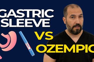 Gastric Sleeve vs Ozempic: Which Works Better for Weight Loss?